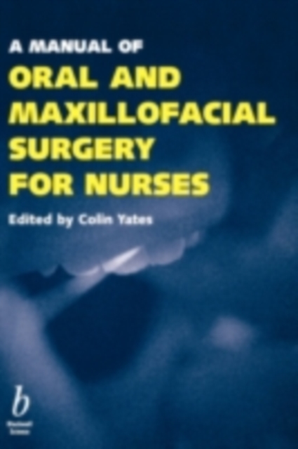 A Manual of Oral and Maxillofacial Surgery for Nurses, PDF eBook