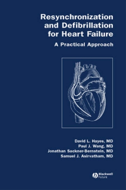 Resynchronization and Defibrillation for Heart Failure : A Practical Approach, PDF eBook