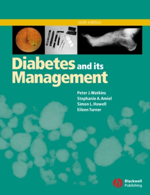 Diabetes and Its Management, PDF eBook