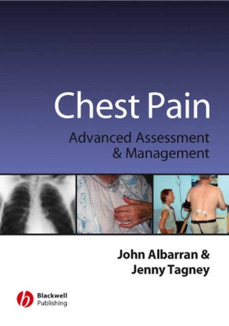 Chest Pain : Advanced Assesment and Management Skills, PDF eBook