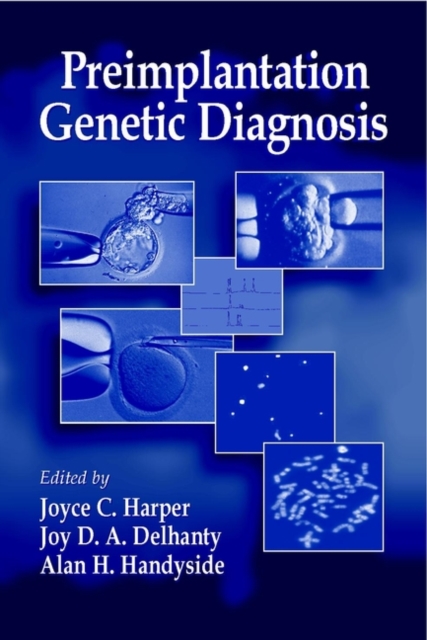 Preimplantation Genetic Diagnosis, PDF eBook