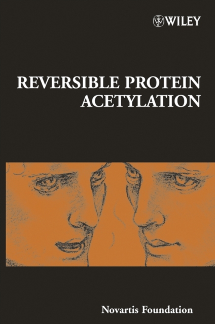 Reversible Protein Acetylation, Hardback Book