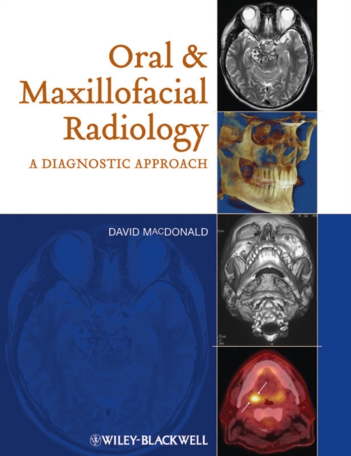 Oral and Maxillofacial Radiology : A Diagnostic Approach, PDF eBook