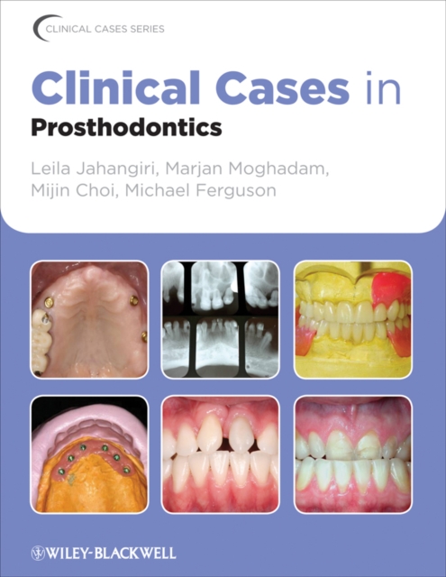 Clinical Cases in Prosthodontics, EPUB eBook