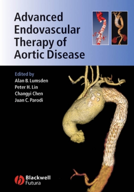 Advanced Endovascular Therapy of Aortic Disease, PDF eBook