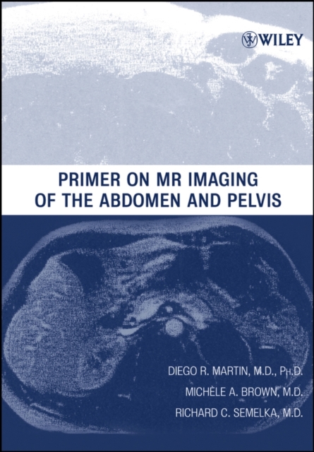 Primer on MR Imaging of the Abdomen and Pelvis, Paperback / softback Book