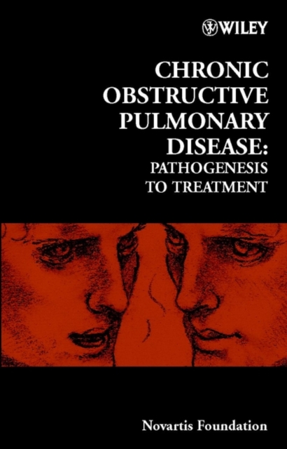 Chronic Obstructive Pulmonary Disease : Pathogenesis to Treatment, Hardback Book