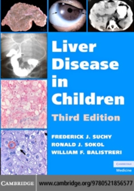 Liver Disease in Children, PDF eBook