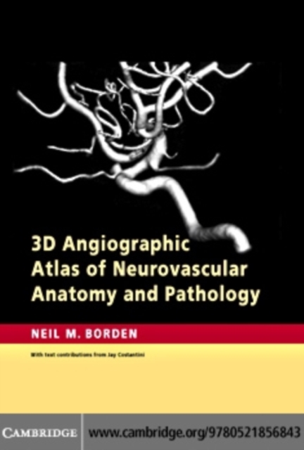 3D Angiographic Atlas of Neurovascular Anatomy and Pathology, PDF eBook