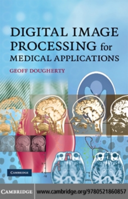 Digital Image Processing for Medical Applications, PDF eBook