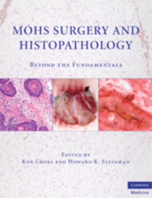 Mohs Surgery and Histopathology : Beyond the Fundamentals, PDF eBook