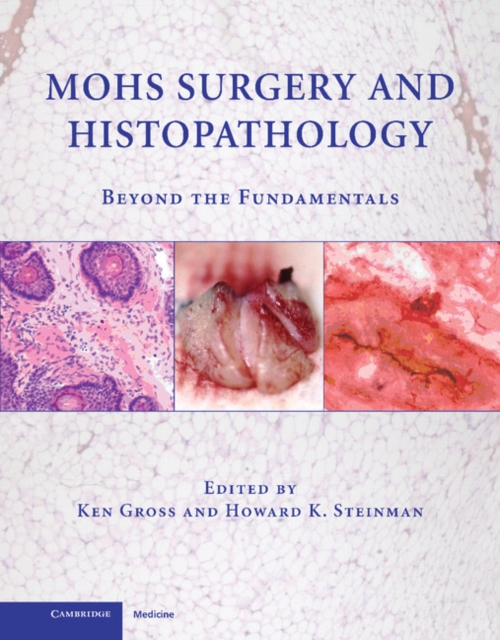 Mohs Surgery and Histopathology : Beyond the Fundamentals, EPUB eBook