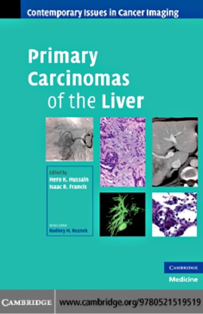 Primary Carcinomas of the Liver, PDF eBook