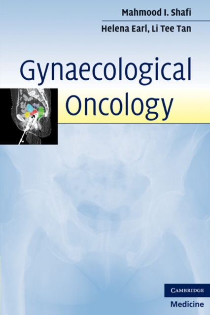Gynaecological Oncology, EPUB eBook