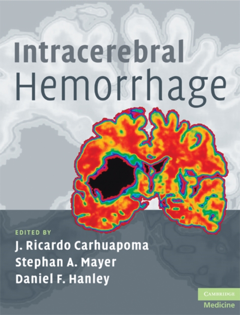 Intracerebral Hemorrhage, EPUB eBook