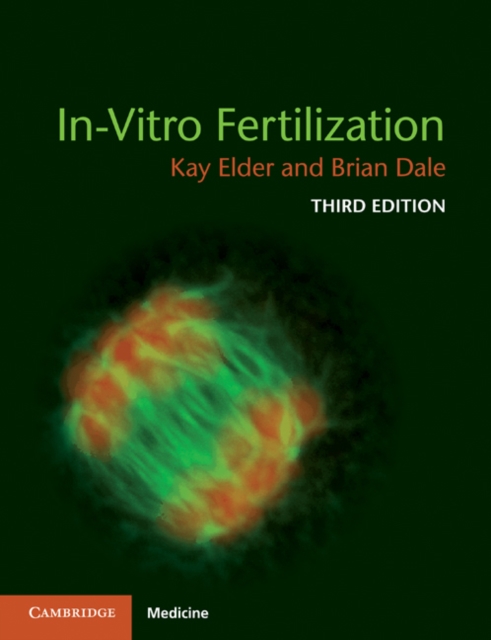 In-Vitro Fertilization, EPUB eBook