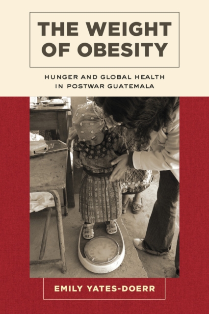 The Weight of Obesity : Hunger and Global Health in Postwar Guatemala, Hardback Book