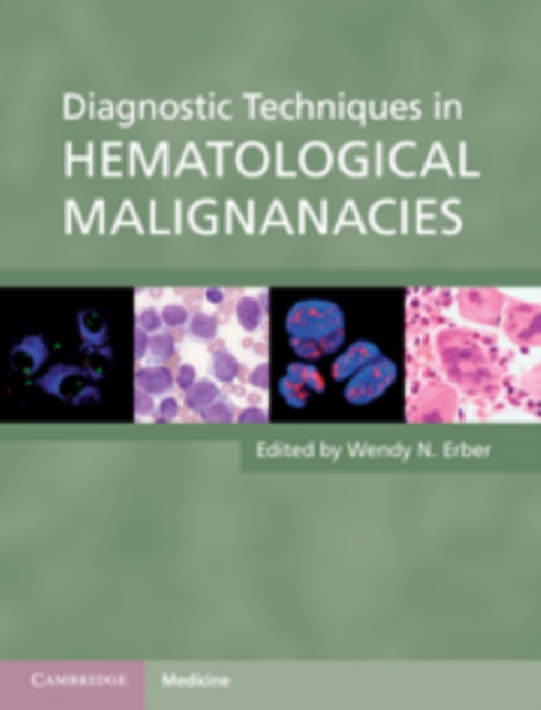 Diagnostic Techniques in Hematological Malignancies, Hardback Book