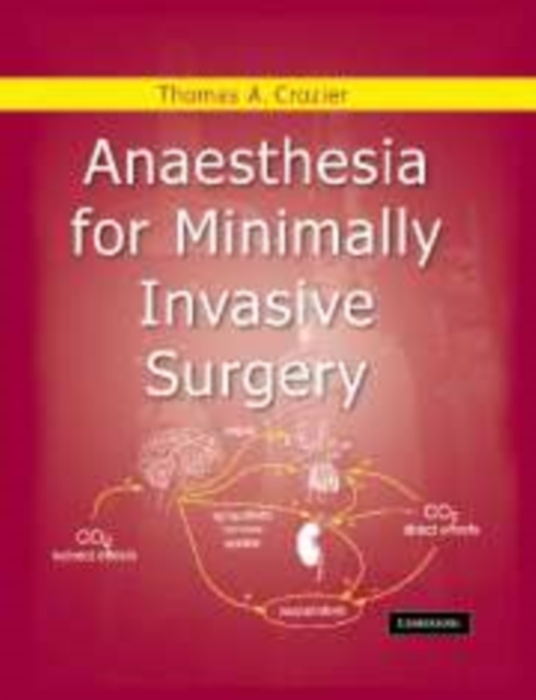 Anaesthesia for Minimally Invasive Surgery, Paperback / softback Book