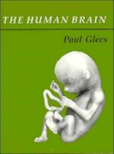 The Human Brain, Hardback Book