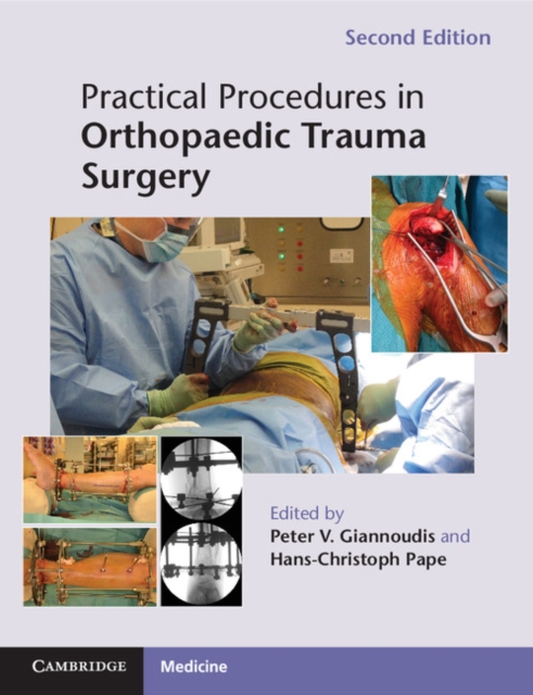 Practical Procedures in Orthopaedic Trauma Surgery, Paperback / softback Book