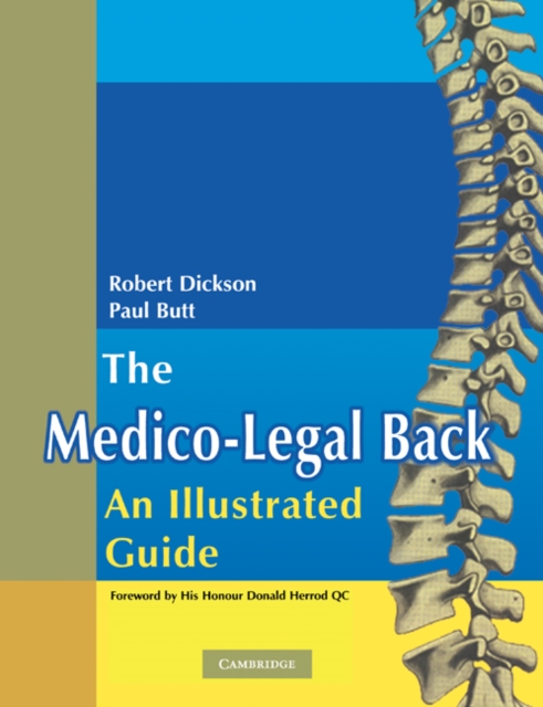 The Medico-Legal Back: An Illustrated Guide, Paperback / softback Book
