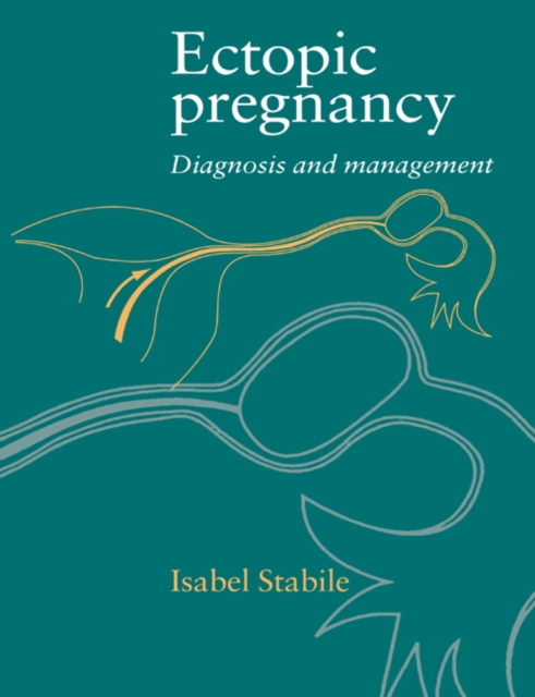Ectopic Pregnancy : Diagnosis and Management, Paperback / softback Book
