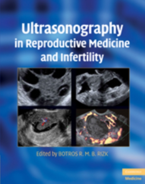 Ultrasonography in Reproductive Medicine and Infertility, Hardback Book