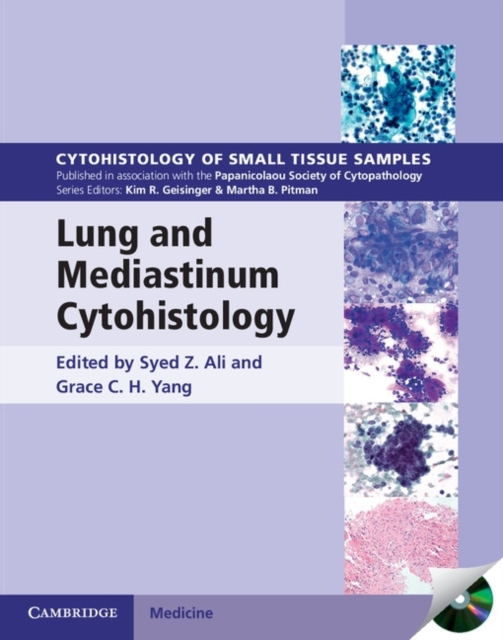 Lung and Mediastinum Cytohistology with CD-ROM, Multiple-component retail product, part(s) enclose Book