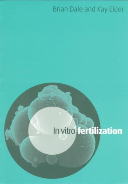 In Vitro Fertilization, Paperback Book