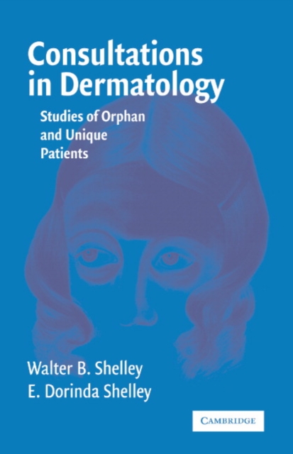 Consultations in Dermatology : Studies of Orphan and Unique Patients, Paperback / softback Book