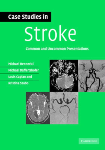 Case Studies in Stroke : Common and Uncommon Presentations, Paperback / softback Book