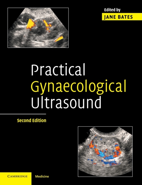 Practical Gynaecological Ultrasound, Paperback / softback Book