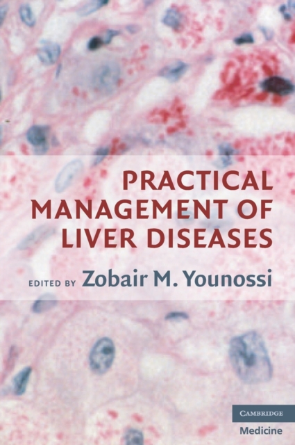 Practical Management of Liver Diseases, Hardback Book