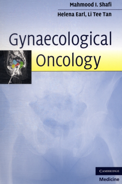 Gynaecological Oncology, Paperback / softback Book
