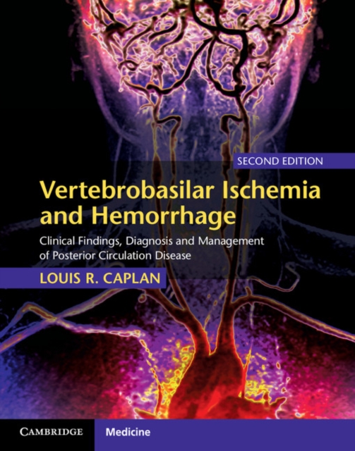 Vertebrobasilar Ischemia and Hemorrhage : Clinical Findings, Diagnosis and Management of Posterior Circulation Disease, Hardback Book