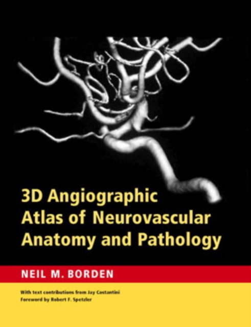 3D Angiographic Atlas of Neurovascular Anatomy and Pathology, Hardback Book