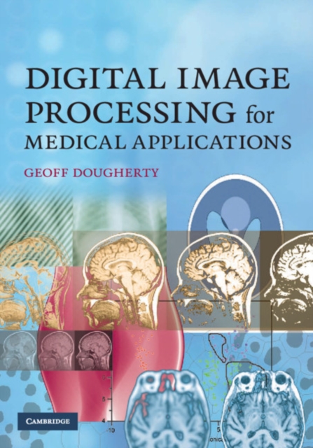 Digital Image Processing for Medical Applications, Hardback Book