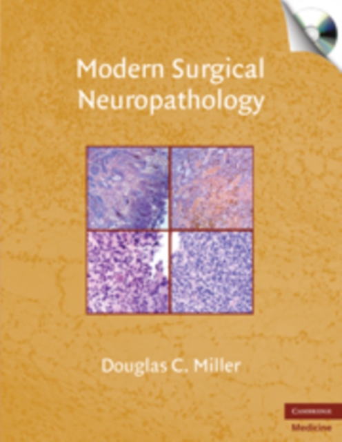 Modern Surgical Neuropathology with CD-ROM, Multiple-component retail product, part(s) enclose Book