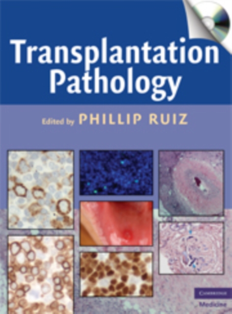 Transplantation Pathology, Mixed media product Book