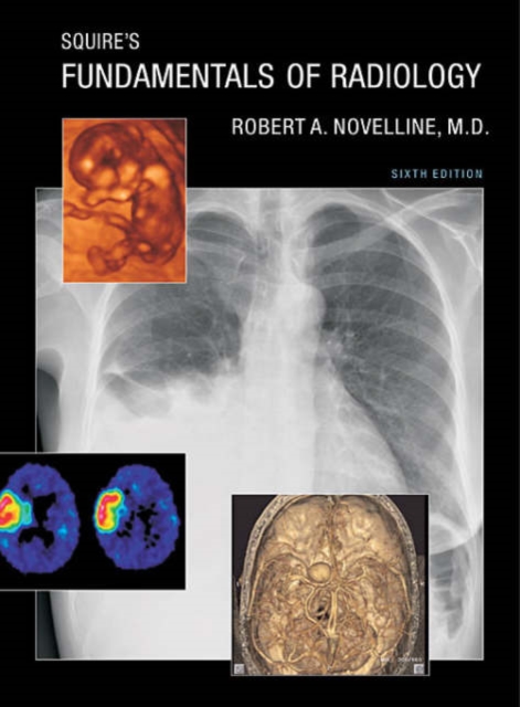 Squire's Fundamentals of Radiology : Sixth Edition, Hardback Book