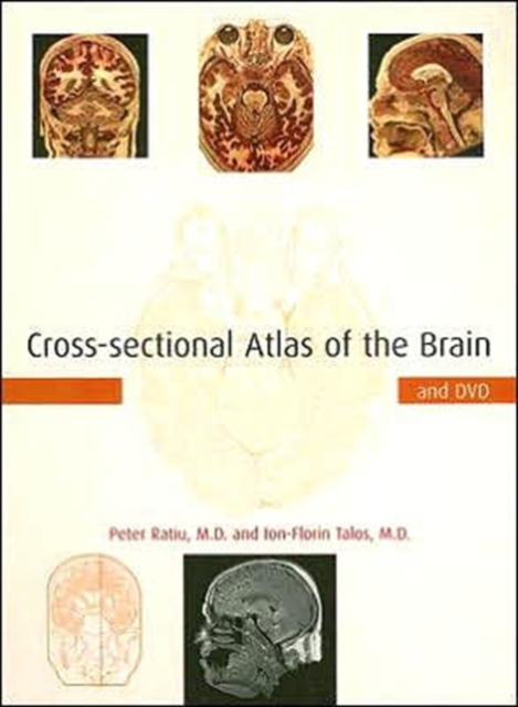 Cross-sectional Atlas of the Brain and DVD, Hardback Book