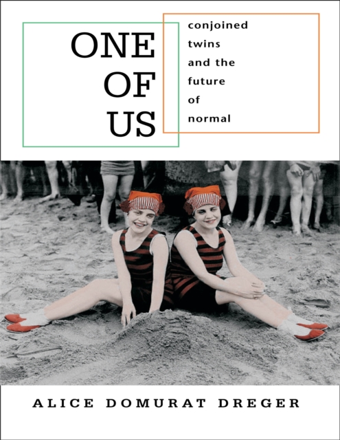 One of Us : Conjoined Twins and the Future of Normal, PDF eBook