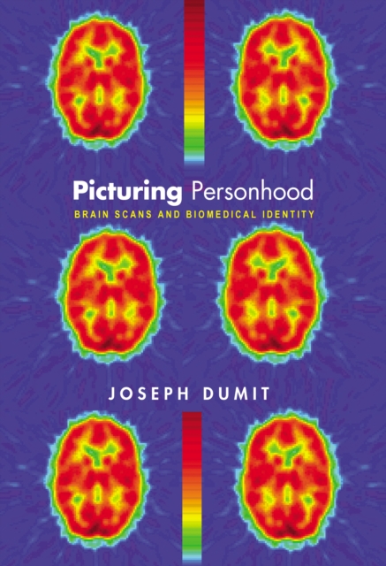 Picturing Personhood : Brain Scans and Biomedical Identity, EPUB eBook