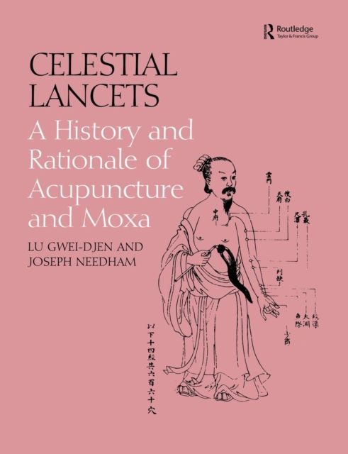 Celestial Lancets : A History and Rationale of Acupuncture and Moxa, Paperback / softback Book
