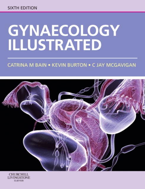 Gynaecology Illustrated, Paperback / softback Book