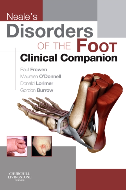 Neale's Disorders of the Foot Clinical Companion, Paperback / softback Book