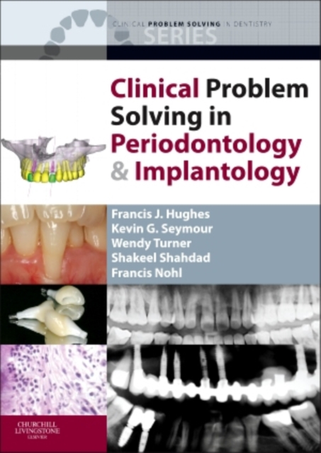 Clinical Problem Solving in Periodontology and Implantology, Paperback Book