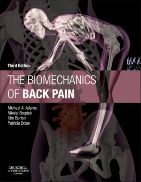 The Biomechanics of Back Pain, Hardback Book