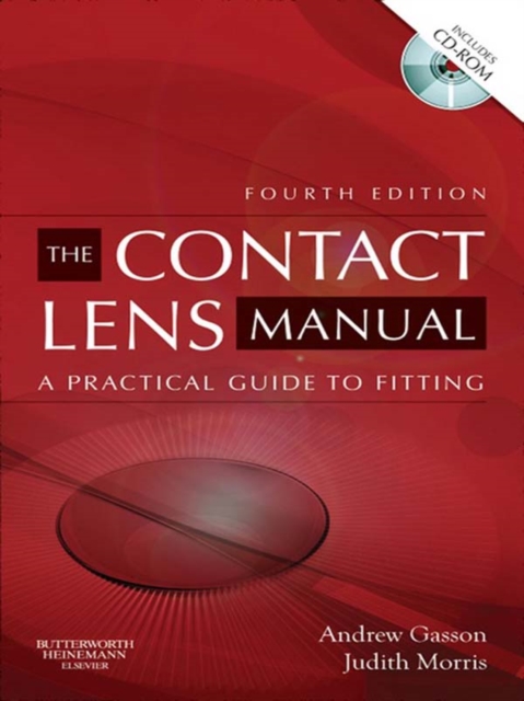 The Contact Lens Manual : A Practical Guide to Fitting, EPUB eBook